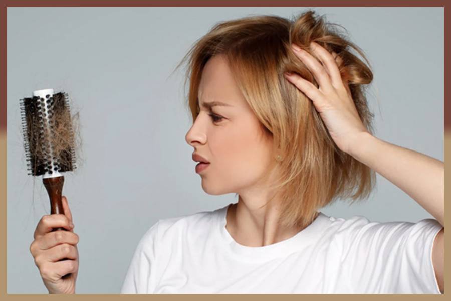 علت ریزش شدید مو در زنان