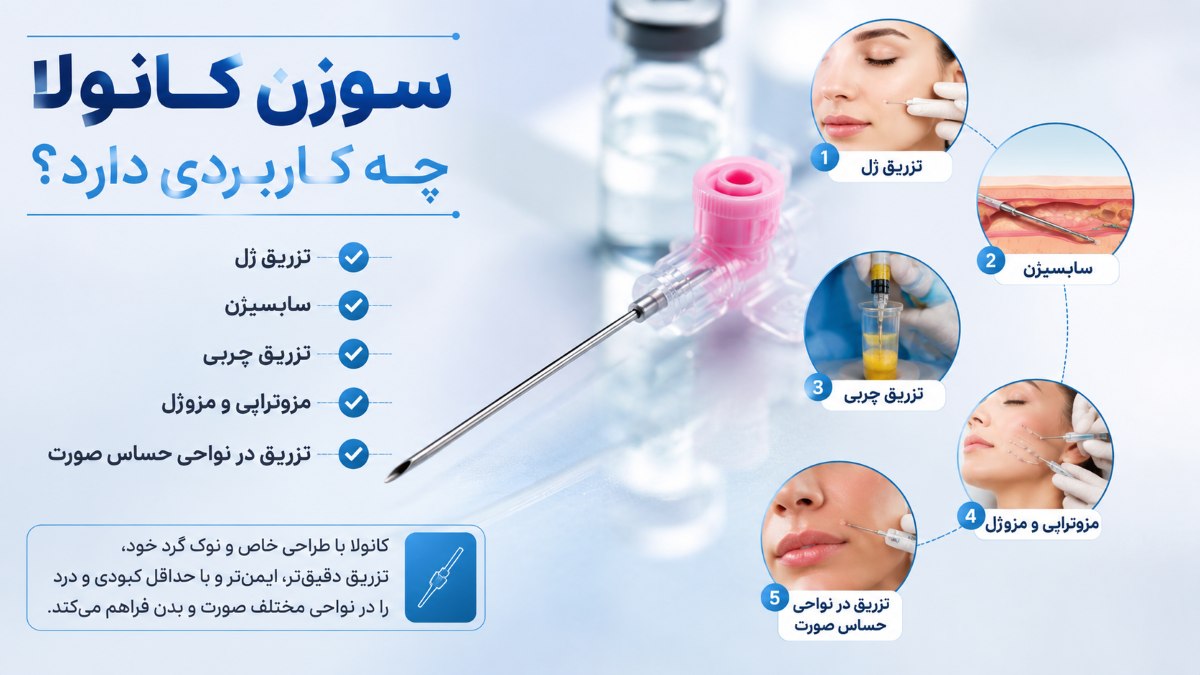 انواع کانولا برای تزریق
